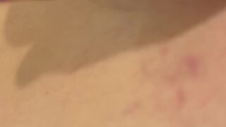 Anal Gape